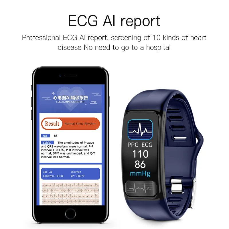 Bracelet Connecté de Suivi de  - Couple Watches Smartwatch avis et prix